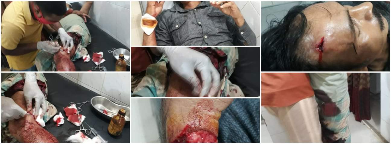 ওসি মর্জিনার নির্দেশেই সাংবাদিক ইয়াকিনের পরিবারের উপর সন্ত্রাসী হামলা