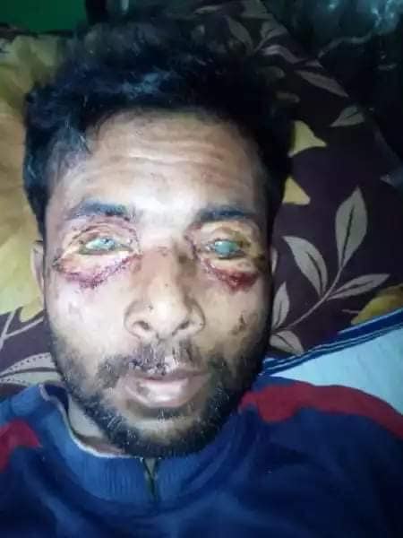 গোয়াইনঘাটে জমি নিয়ে মামলায় হেরে, হাত পা ভেঙে, দুই চোখ নষ্ট করে দিল সন্তাসী,খুনী, জালাল উদ্দীন বাবুল ও তার ভাই।