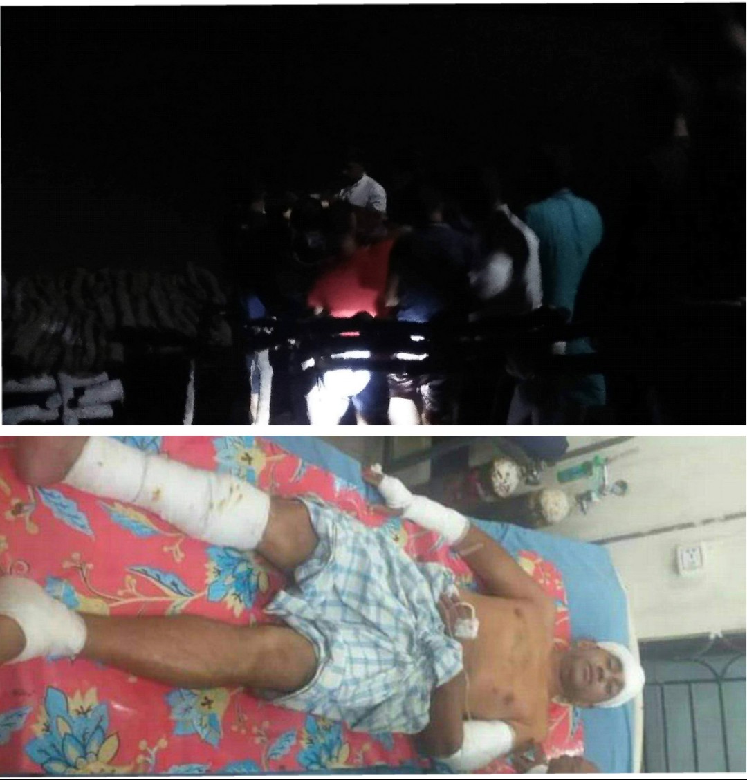 সন্দ্বীপে ব্যক্তিগত আক্রোশে সাবেক ছাত্রনেতাকে ডেকে নিয়ে হত্যার চেষ্টা 