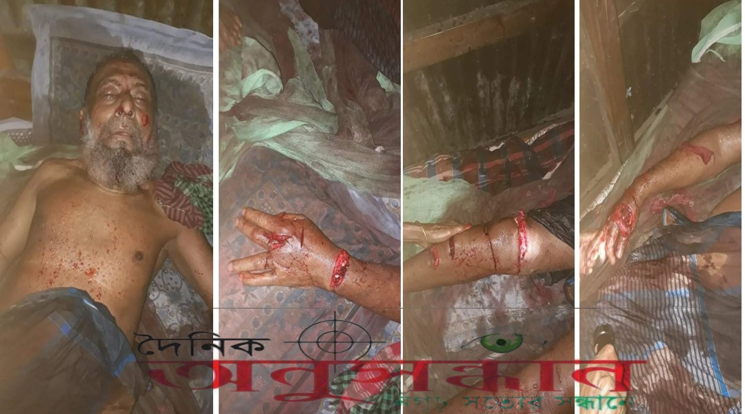 সন্দ্বীপে আবারও পান্নার পরিবারের উপর  সন্ত্রাসী হামলা