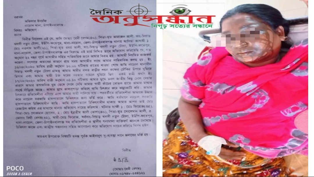 নাচোলে স্বামীর বিরুদ্ধে  স্ত্রীর মুখ ঝলসে দেয়ার অভিযোগ