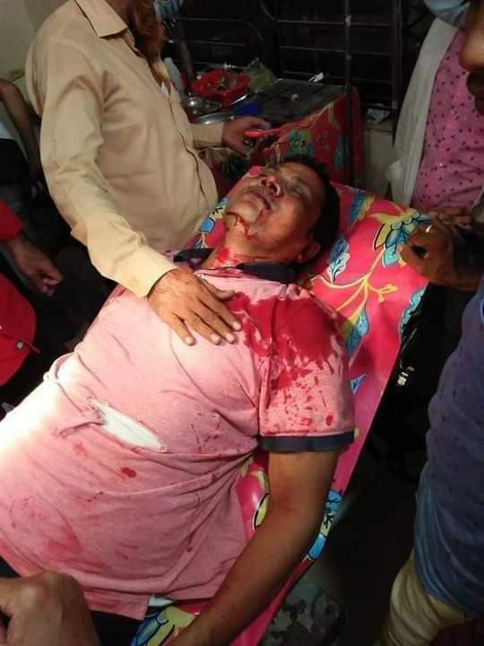 সংসদের একান্ত সহকারী সড়ক দুর্ঘটনায় আহত।