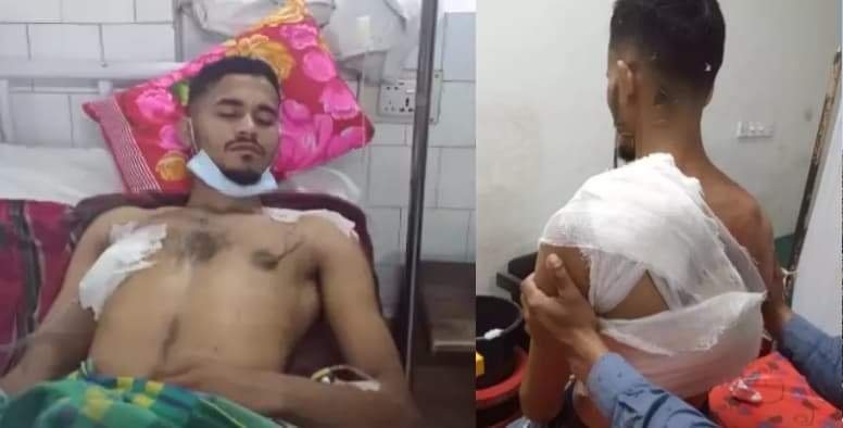খুটাখালীতে ফুটবল খেলার জের ধরে প্রকাশ্যে যুবককে ধারালো অস্ত্র দিয়ে কুপিয়ে জখম