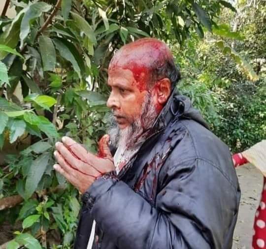 ফেনীতে ইভটিজিং এর প্রতিবাদ করায় মেয়ের বাবাকে পিটিয়ে রক্তাক্ত করলো বখাটে যুবক