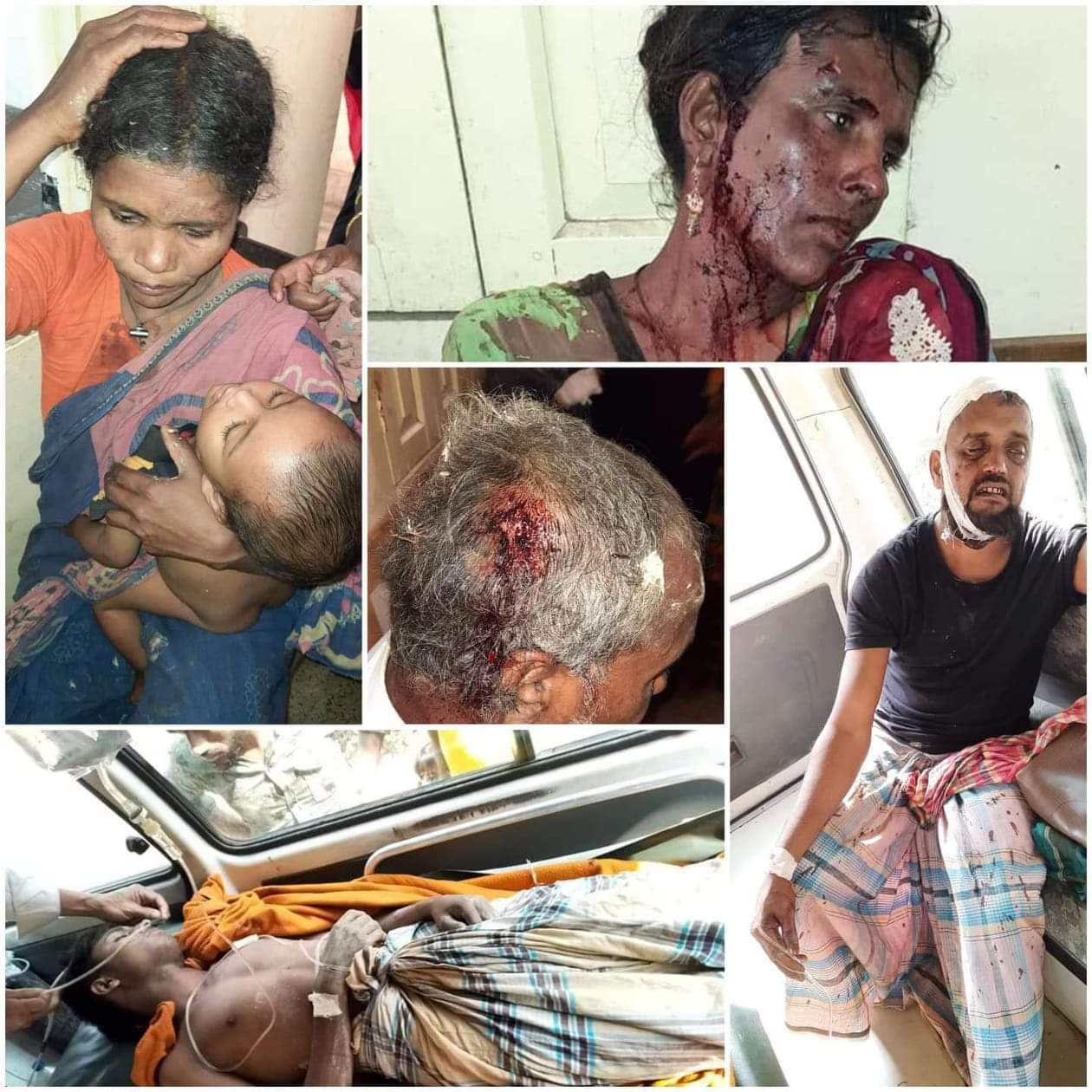 বান্দরবানের লামায় মাছের প্রজেক্টের জমি বিরোধকে কেন্দ্র করে দু'পক্ষের সংঘর্ষ আহত ১৭