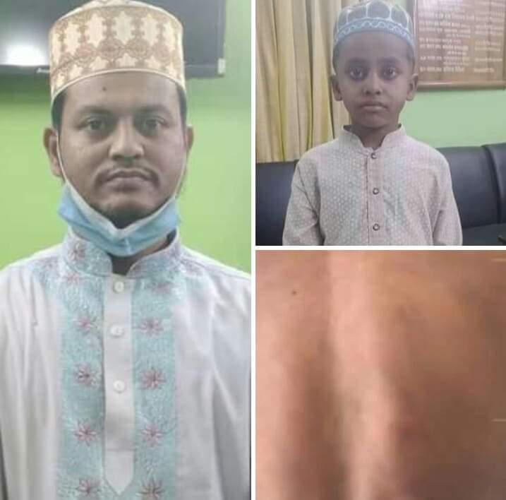 চট্টগ্রামের ফটিকছড়িতে মাদ্রাসা ছাত্রকে বেধড়ক মারধরের অভিযোগে শিক্ষক আটক