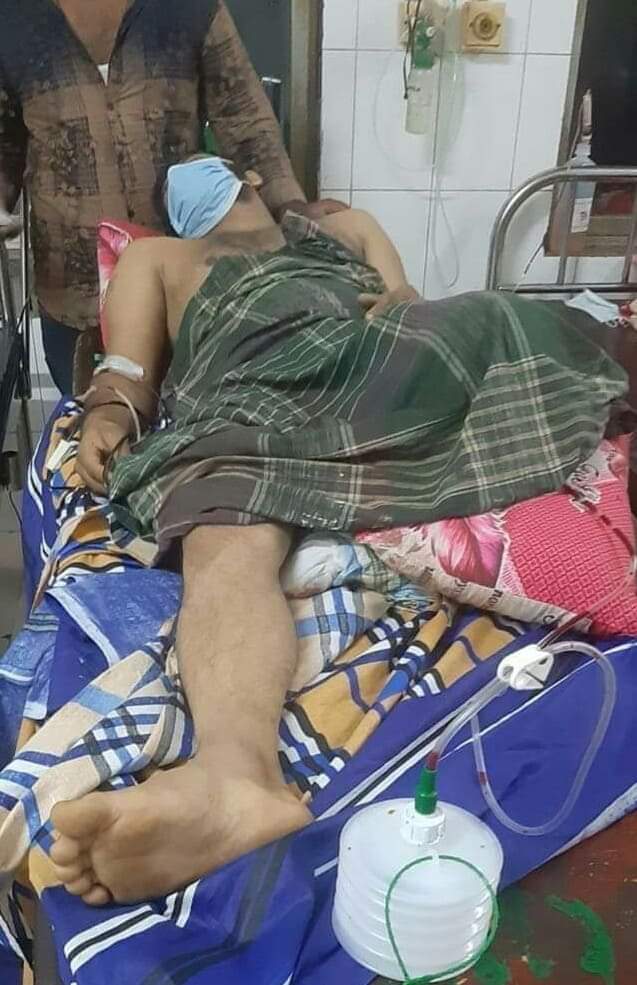 বায়েজিদ থানা পুলিশের গুলিতে আহত সেই ছাত্রদল নেতা সাইফের একটি পা- ই কেটে ফেলতে হয়েছে
