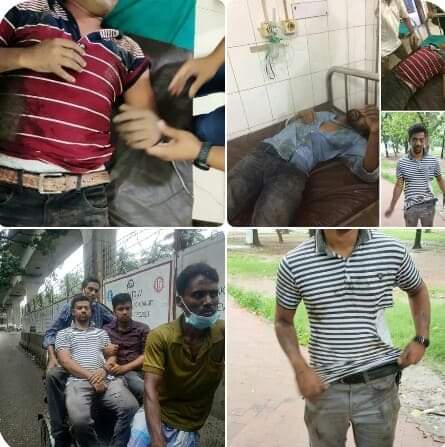 ঢাবির, টিএসসিতে ছাত্রদলের খাবার বিতরণ কর্মসূচিতে ছাত্রলীগের বর্বর হামলা,আহত ৩০