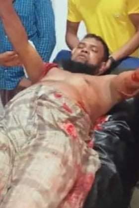 আলীকদমের ২নং চৈক্ষ্যং ইউনিয়নে সন্ত্রসী কায়দায় হামলায় ১ ব্যক্তি গুরুতর আহত 