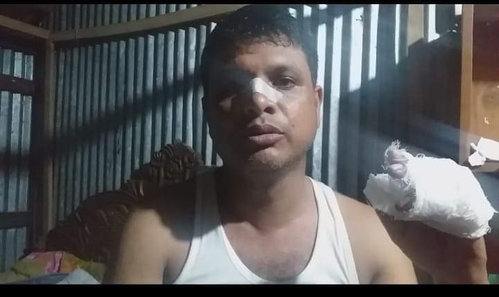সন্দ্বীপে ডাকাতির ঘটনা একজন  আহত  নগদ  টাকা ও স্বর্ণালংকার লুট