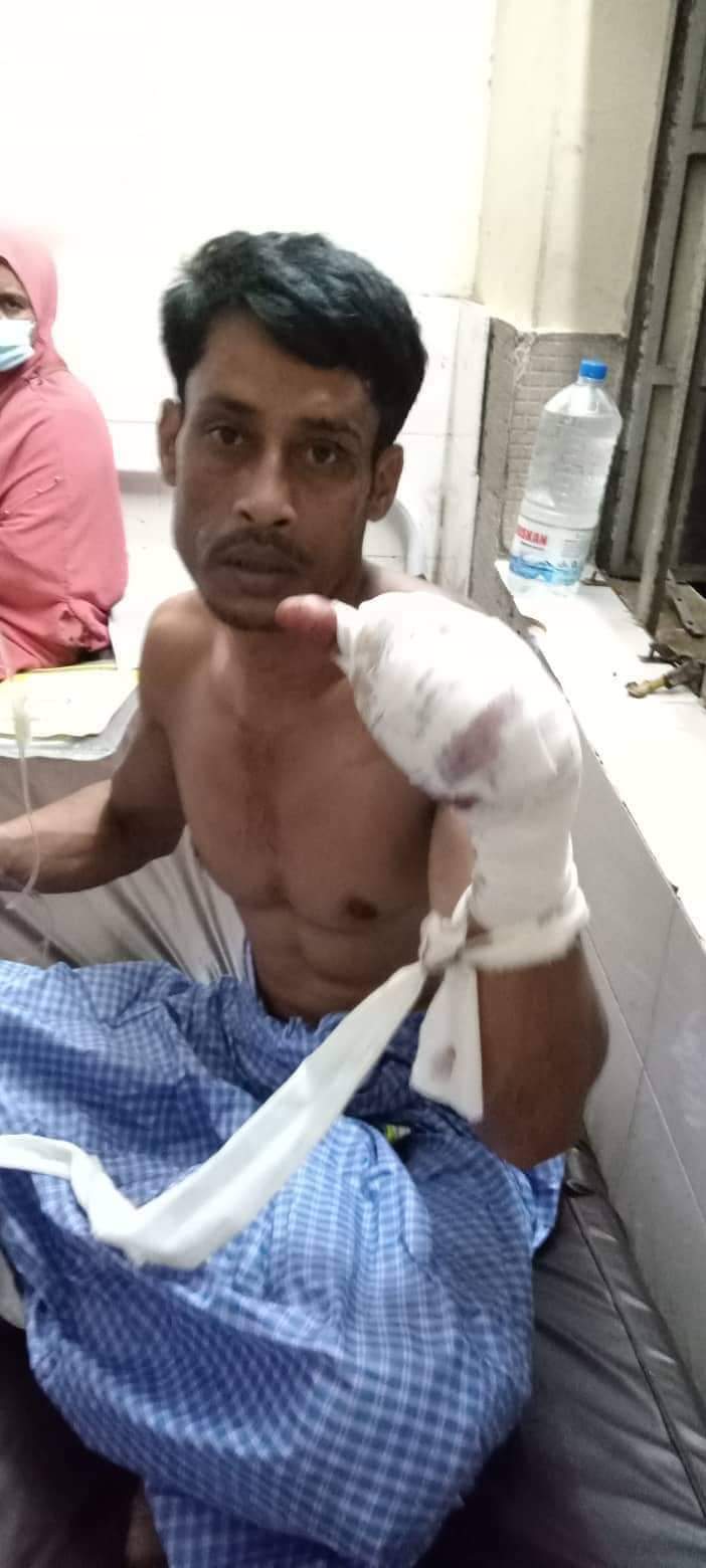 ঈদগাঁও'র জালালাবাদে প্রতিপক্ষের কোপে যুবকের হাত বিচ্ছিন্ন 