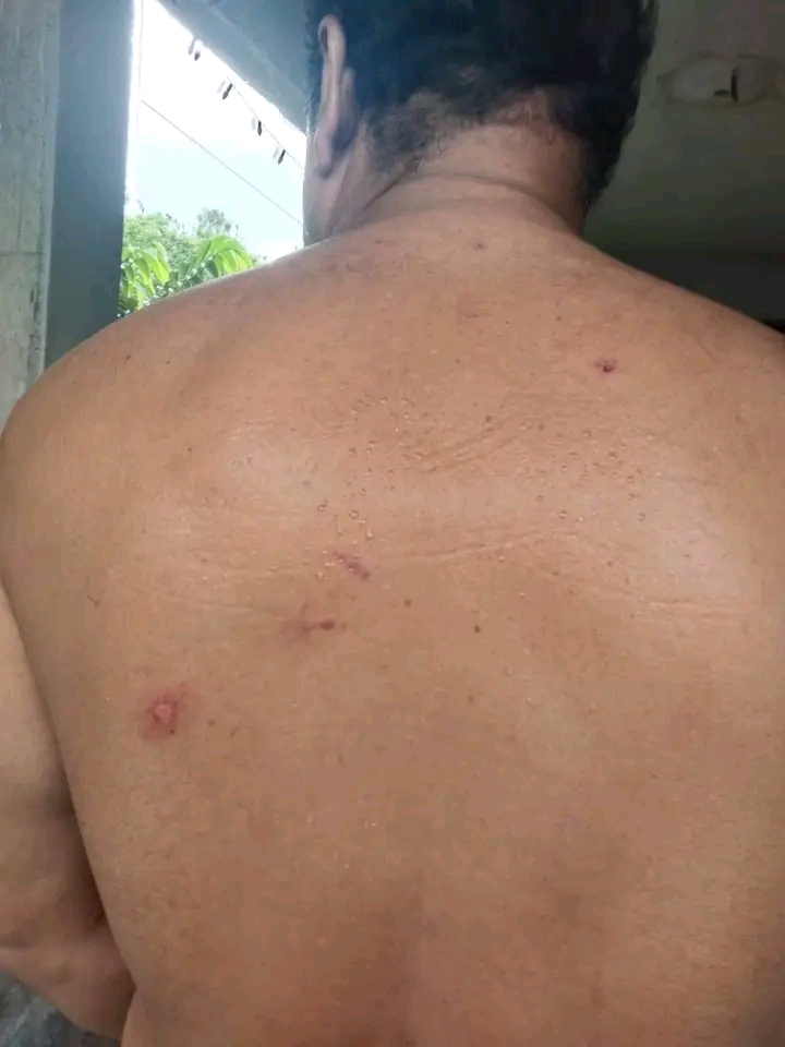 মধুপুরে বাজার কমিটির লোকজনের হাতে সাংবাদিক বাবুল রানা আহত 