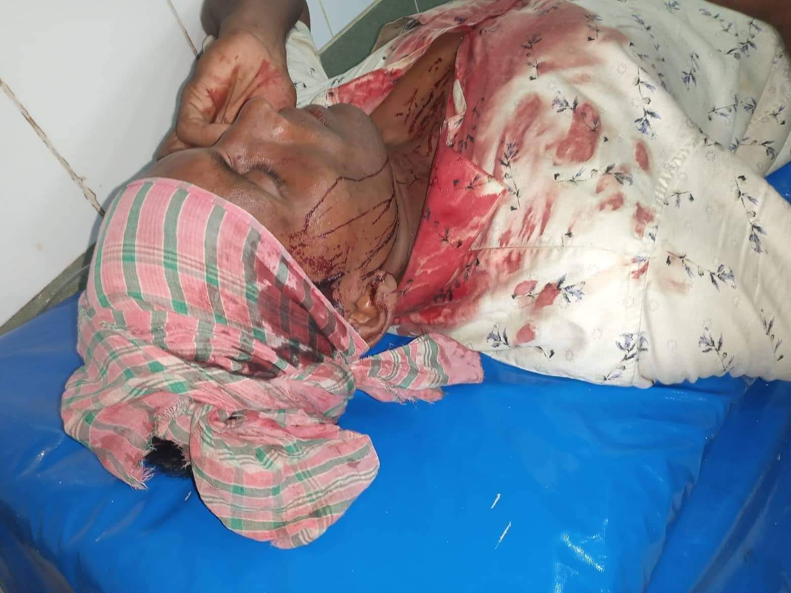 মধুপুরে কবর স্হানের জায়গা দখল করে ঘর তোলার প্রতিবাদ করায়  আহত -২ থানায় মামলা