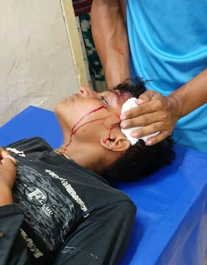চাঁপাইনবাবগঞ্জের শিবগঞ্জ স্টেডিয়ামে ফুটবল খেলায় পরাজিত স্কুলের ছাত্ররা জয়ী দলের ছাত্রদের পিটিয়ে রক্তাক্ত করেছে