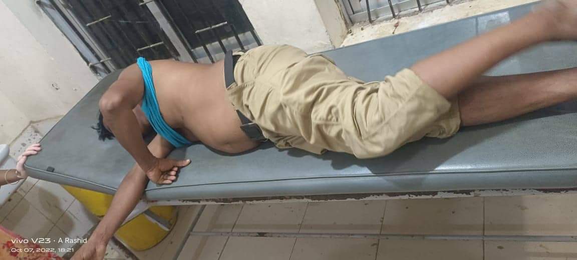 নাইক্ষ্যংছড়িতে সাংবাদিক টুক্কুর উপর সন্ত্রাসী হামলা গুরুতর আহত হয়ে হাসপাতালে,    প্রেস ক্লাবের নিন্দা 