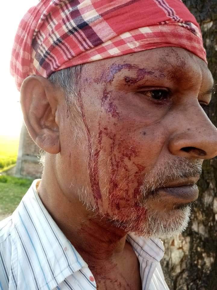 খুটাখালীতে পিতাকে কুপিয়ে জখম করল ছেলে