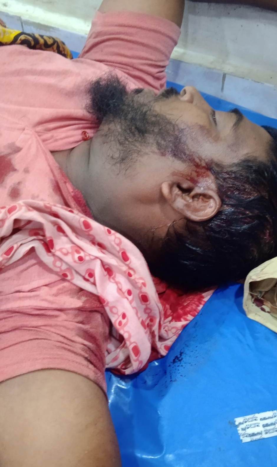 মধুপুরে পূর্ব শত্রুতার জেরে মারপিট ভাংচুর আহত ২