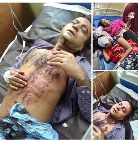 সন্দ্বীপে  স্কুল শিক্ষিকার  বাড়িতে দুধর্ষ ডাকাতি