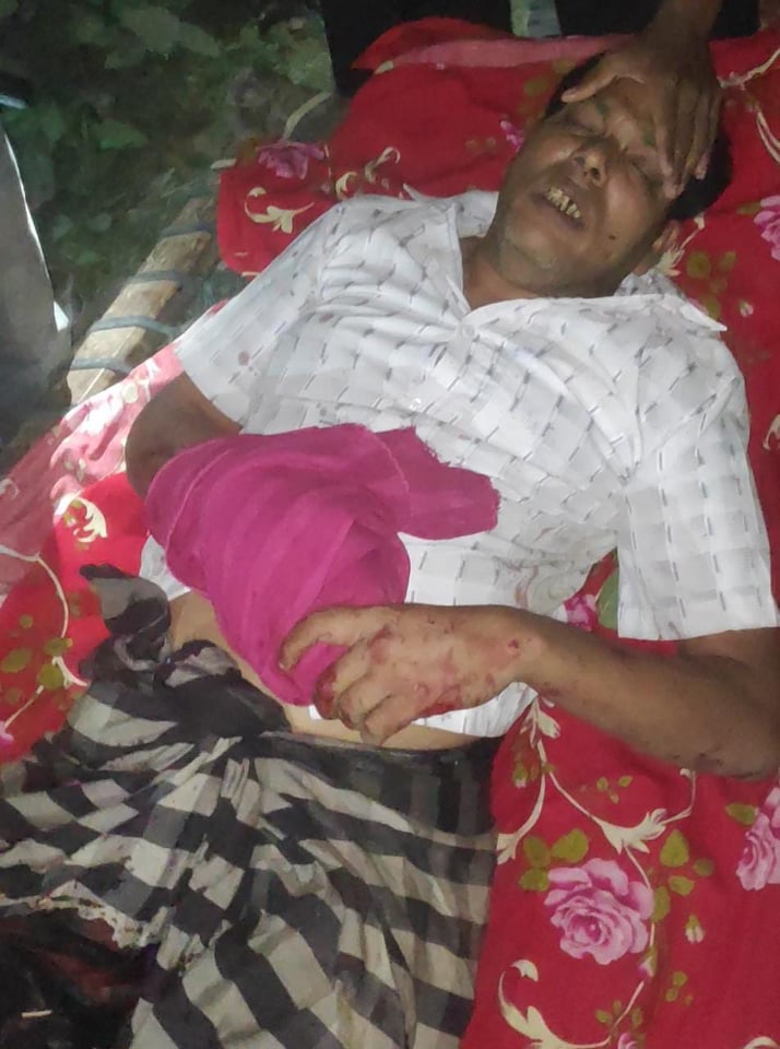 শিবগঞ্জে সন্ত্রাসি হামলায় হাঁসের বাচ্চা ব্যবসায়ী আহত, গ্রেফতার ১