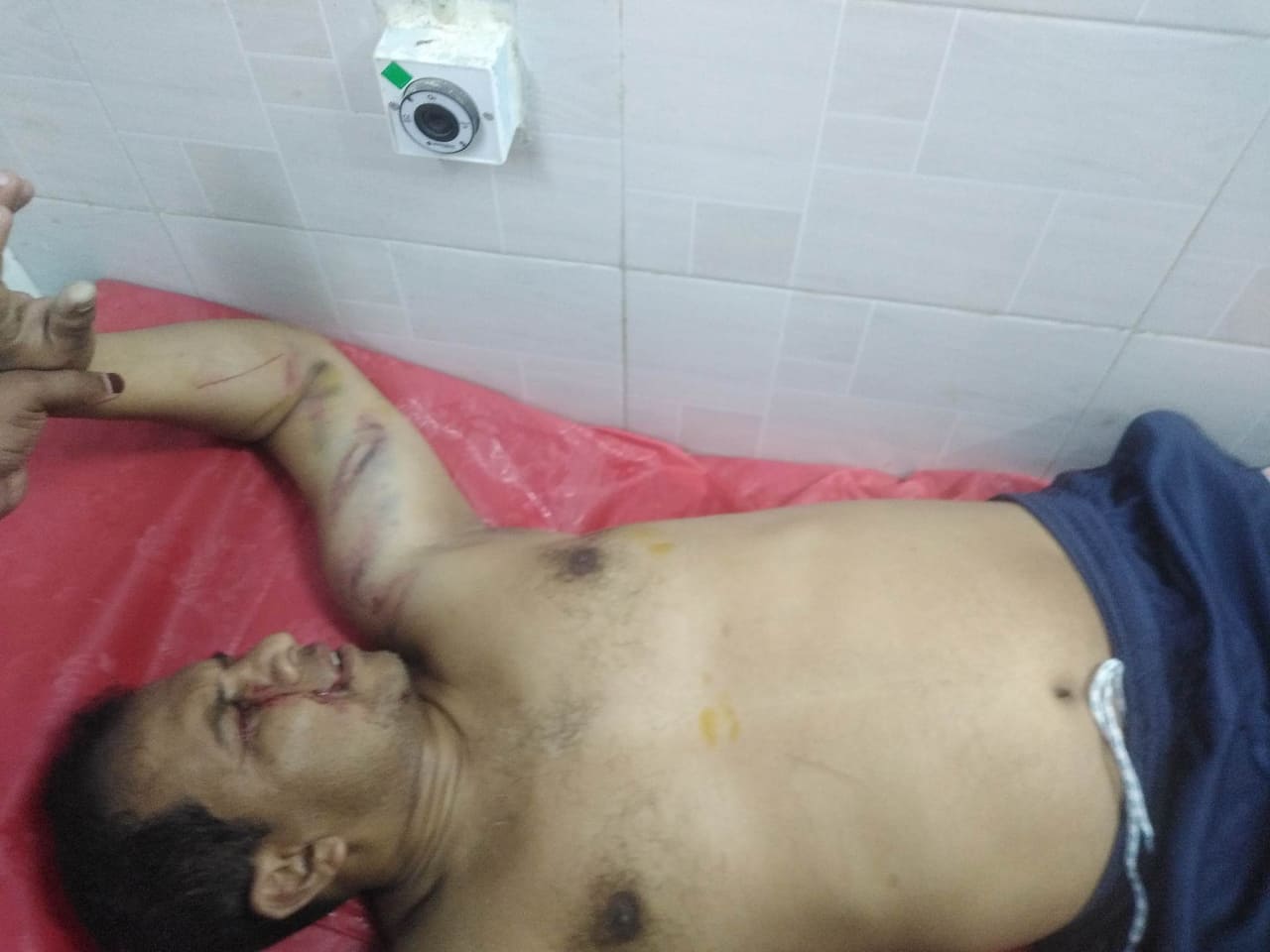সাপাহারে সাংবাদিককে জখম করলেন কথিত সাংবাদিক সম্রাট