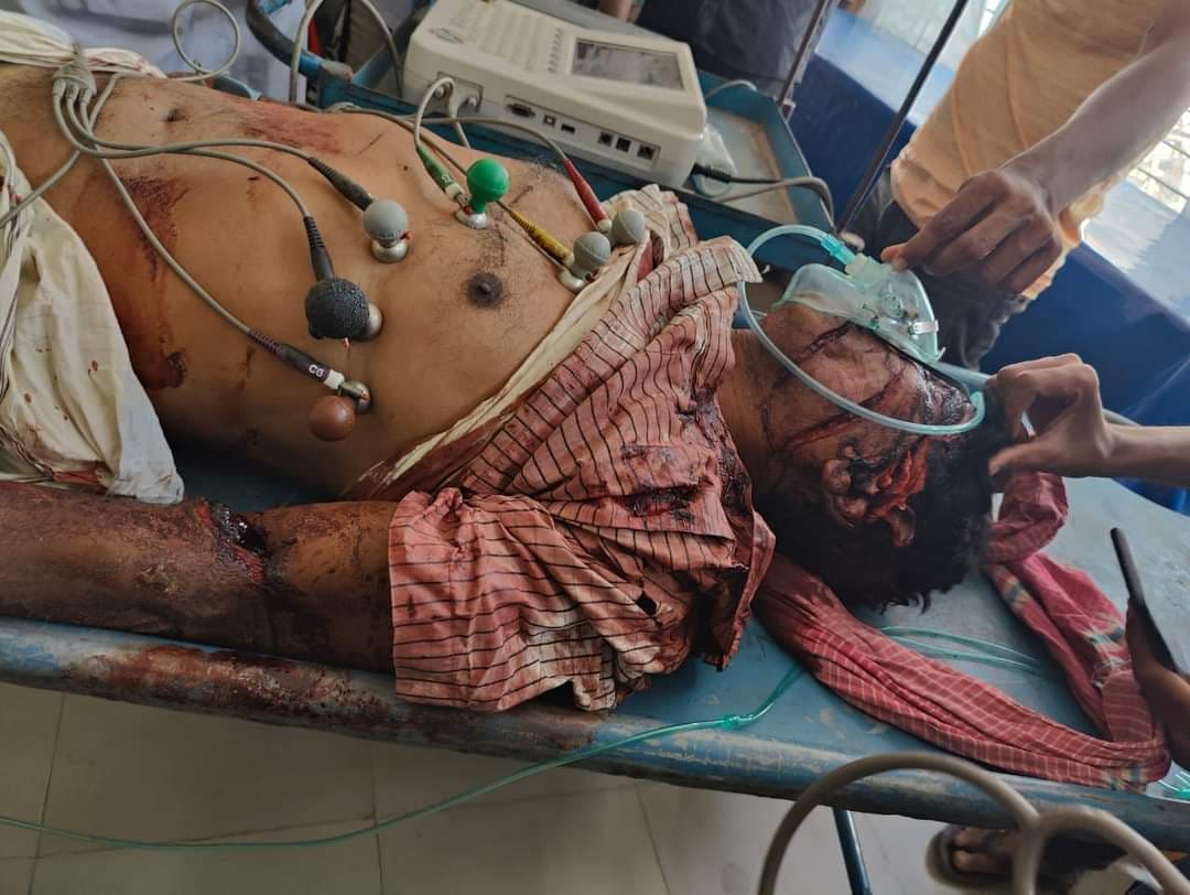 চাঁপাইনবাবগঞ্জে ইউপি সদস্যকে কুপিয়ে হত্যা
