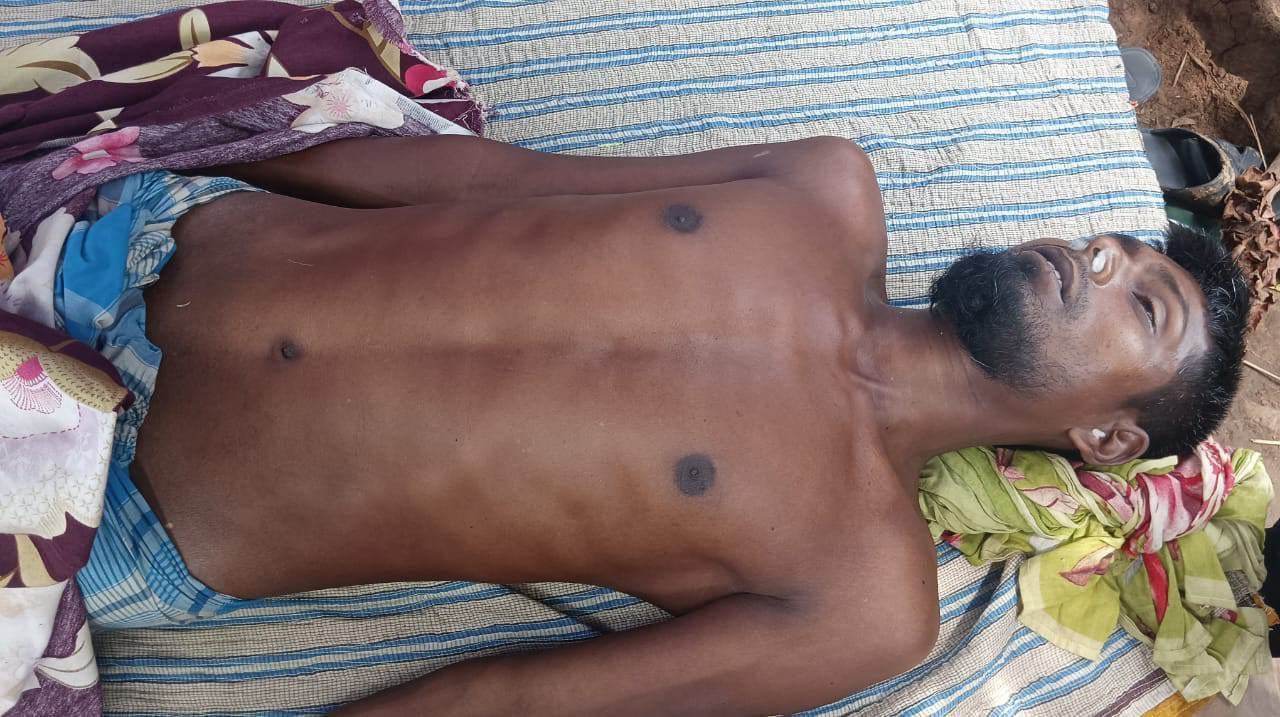 চাঁপাইনবাবগঞ্জের গোমস্তাপুরে বাবার ইটের আঘাতে ছেলের মৃত্যু 
