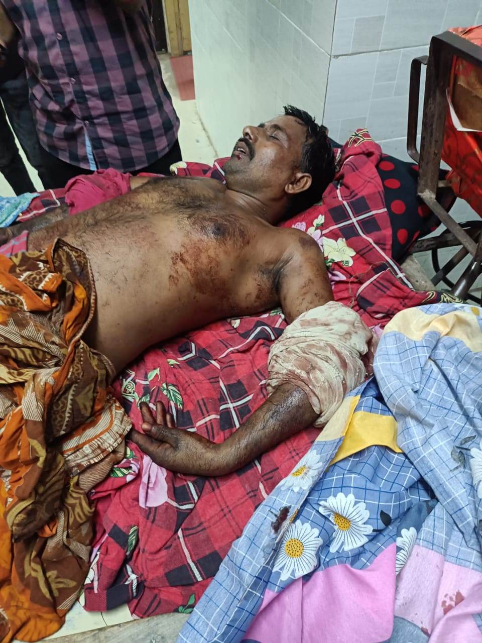 চাঁপাইনবাবগঞ্জের শিবগঞ্জে আলম ঝাপরা হত্যা মামলার আসামিকে হত্যা করেছে দুর্বৃত্তরা 