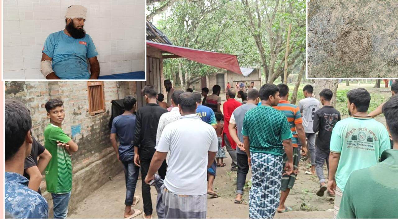 চাঁপাইনবাবগঞ্জে তুচ্ছ ঘটনাকে কেন্দ্র করে প্রতিবন্ধী যুবককে পিটিয়ে আহত করেছে কিশোর গ্যাং