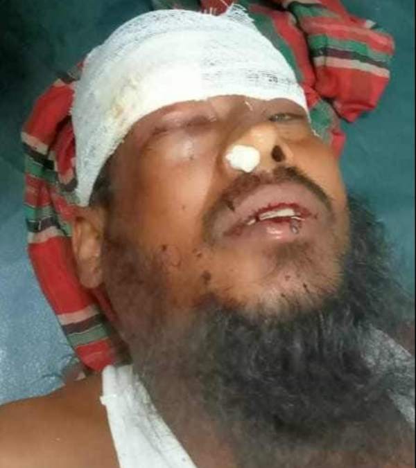 মধুপুরে বাকী না দেয়ায় ব্যবসায়ীকে  মারপিট, টাকা লুট দোকান ভাংচুর