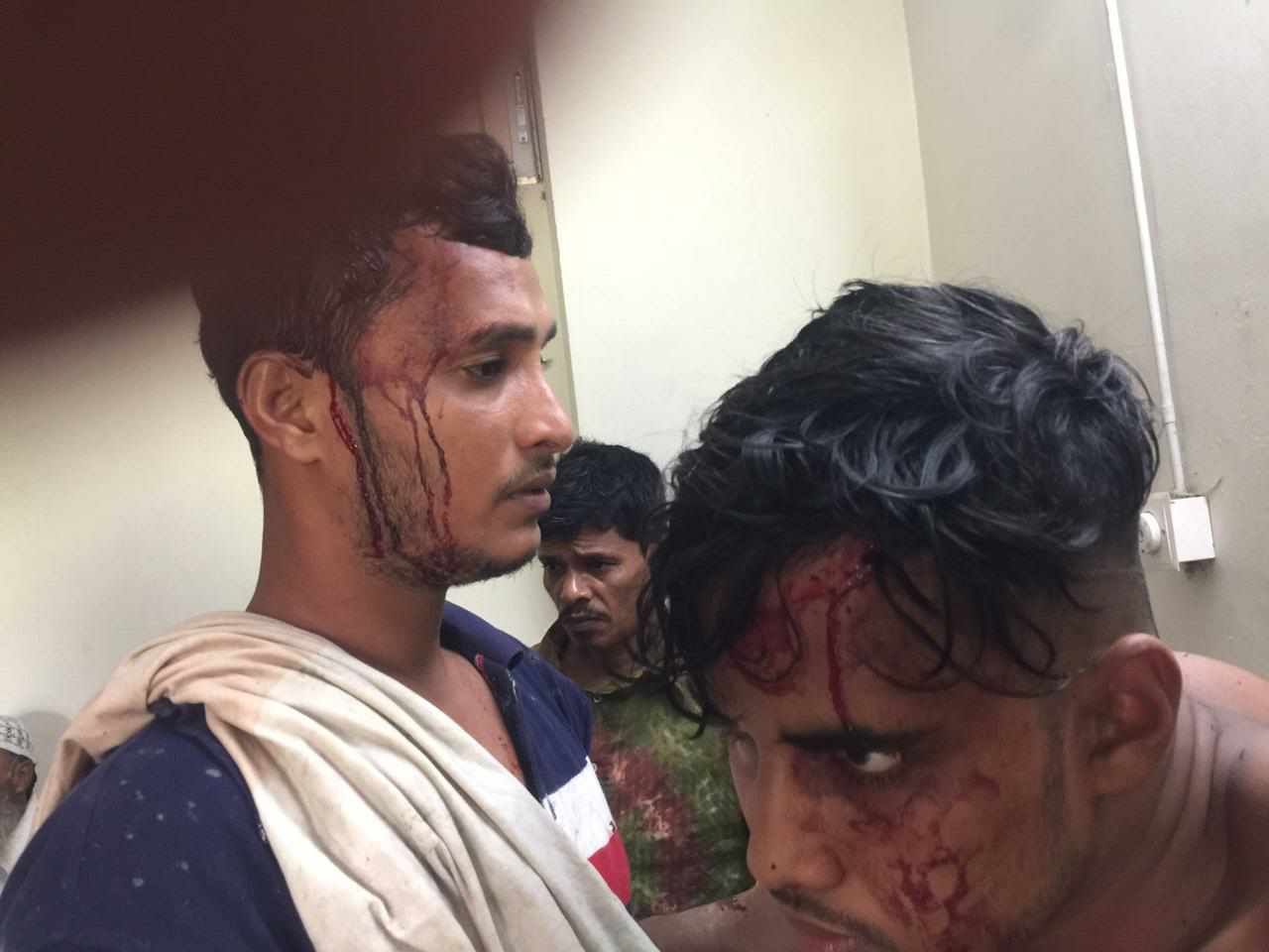 জমি সংক্রান্ত বিরোধের জের ধরে প্রতিপক্ষের হামলায় আহত (৪)