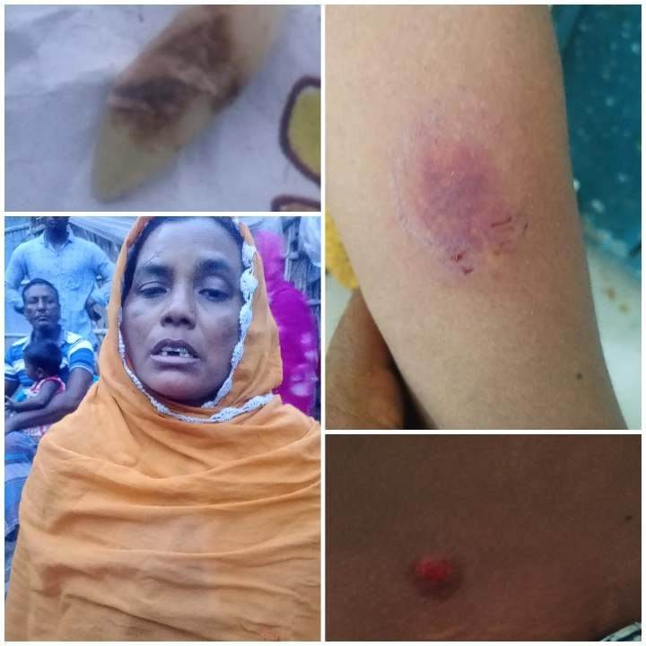 রাজশাহীর গোদাগাড়ীর প্রেমতলীতে স্বামী স্ত্রীর কামড়ে আতঙ্কিত গ্রামবাসী