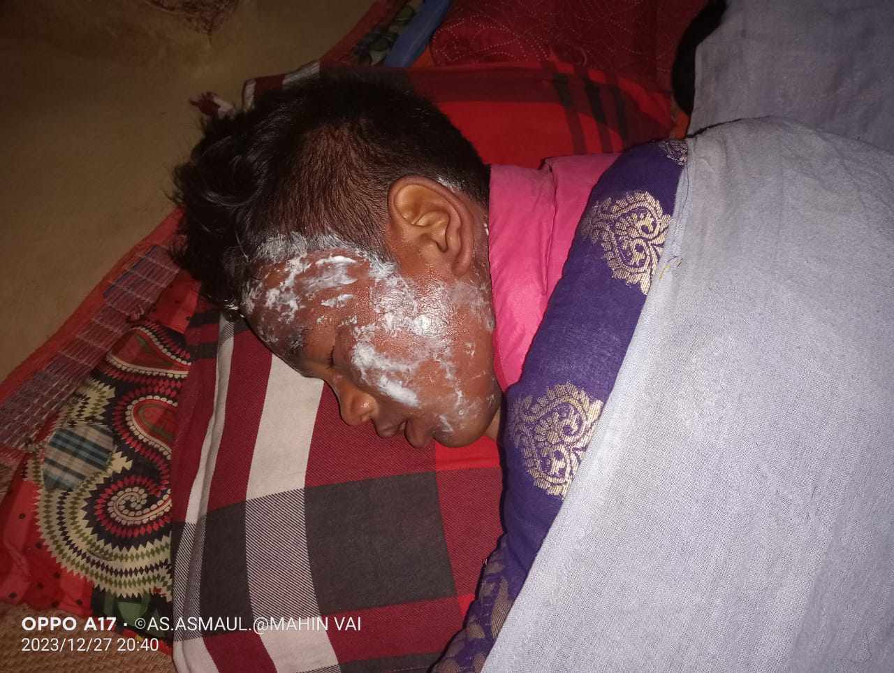 চাঁপাইনবাবগঞ্জে শিবগঞ্জে চা ঢেলে শিশুর শরীর ঝলসে দিল নৌকার সমর্থকরা